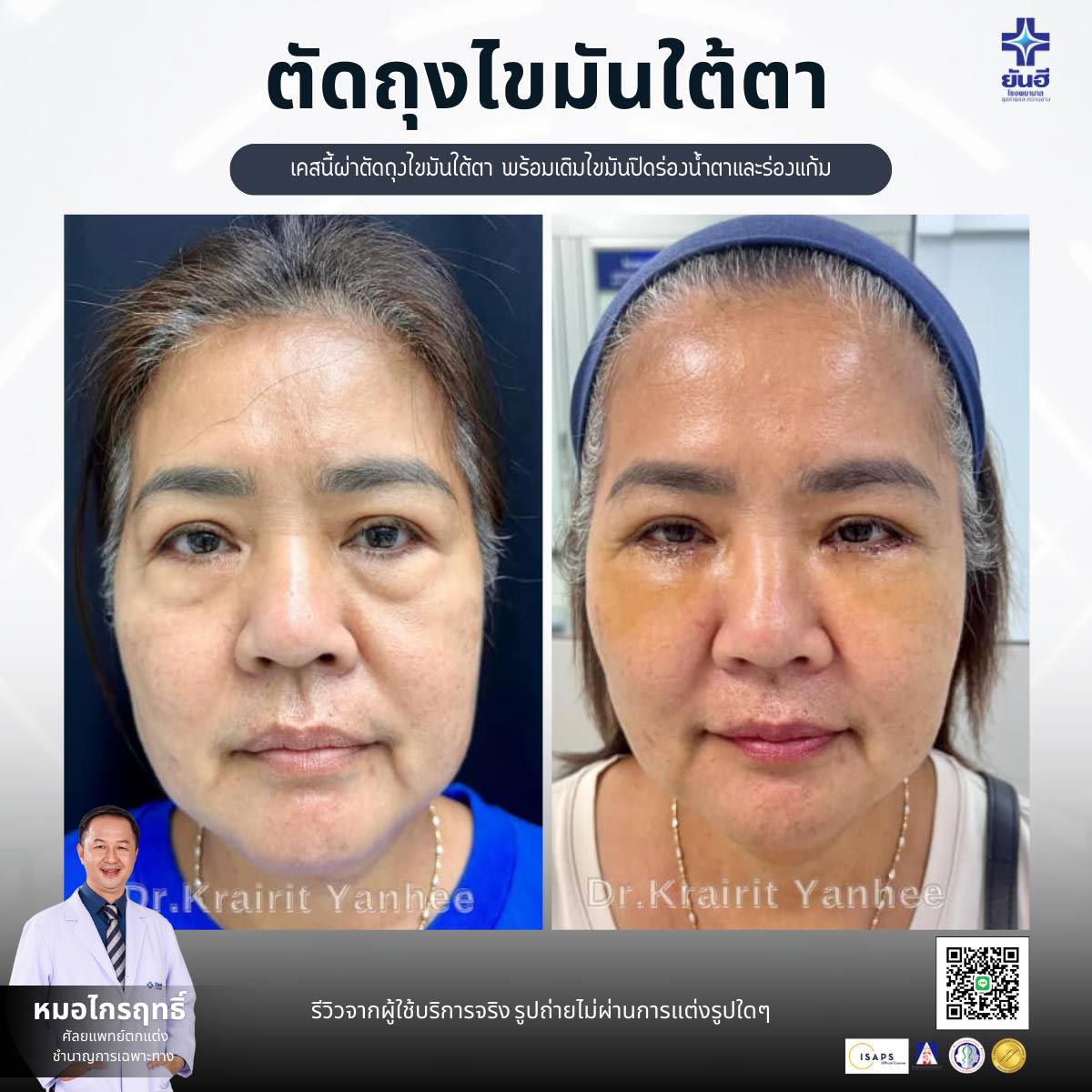 review_home1