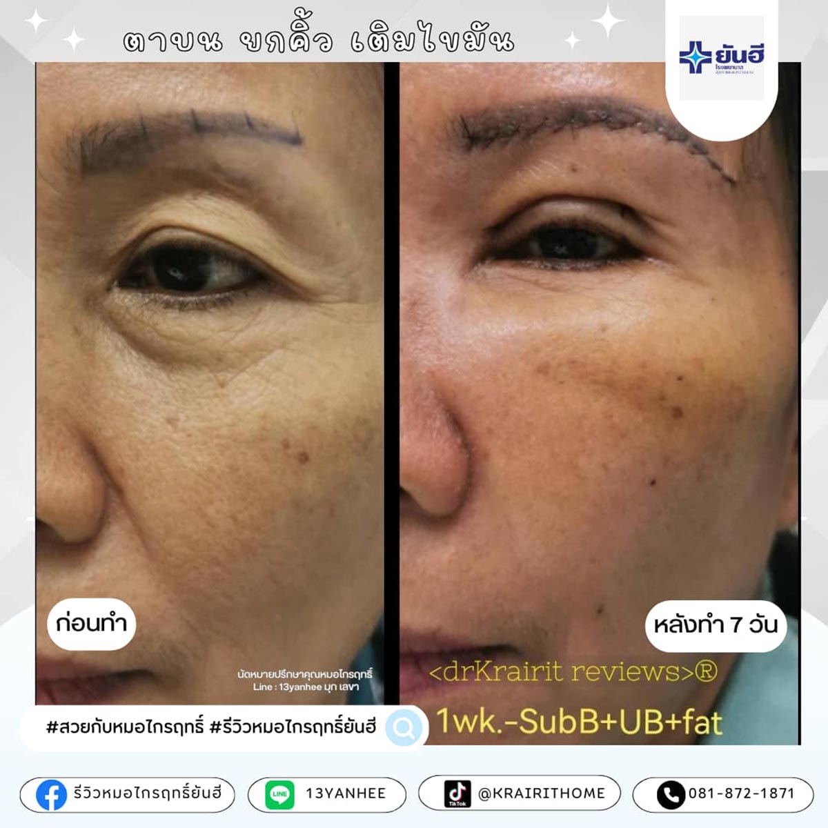 review_home8